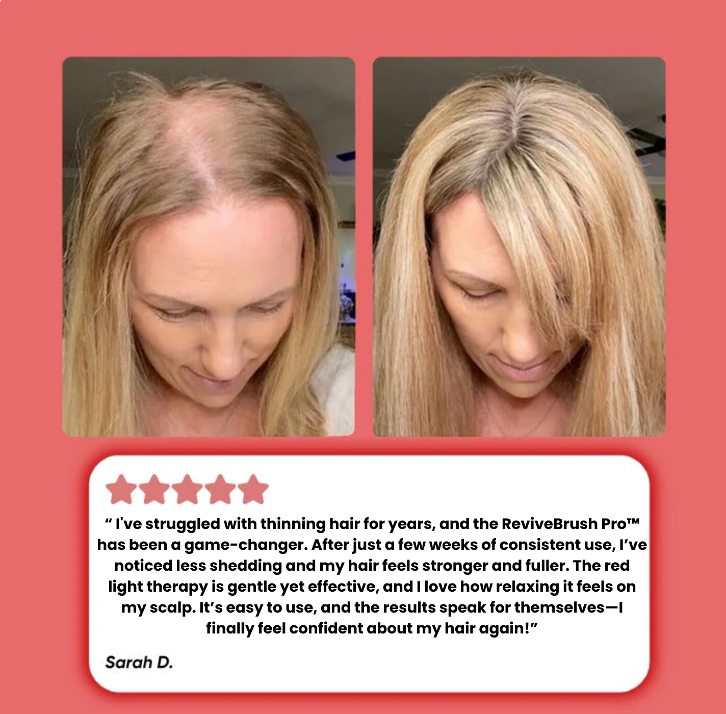 The ReviveBrush Pro™️ – Red Light Therapy for Thicker, Healthier Hair